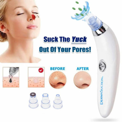 Derma Suction Pore Cleaning Device With Vacuum Action Face Pore Cleaner Facial Beauty Equipment 4 in 1 Black Head Remover